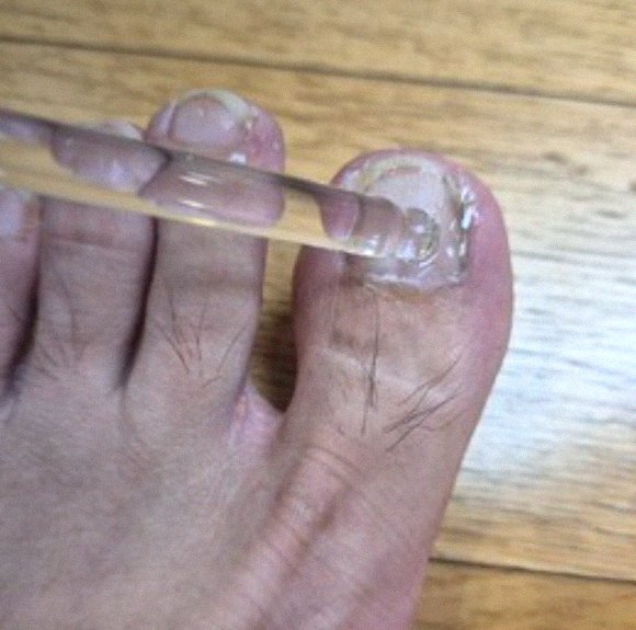 발에 미스트 뿌리는 모습