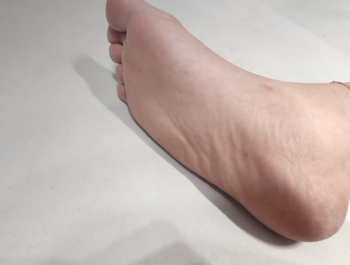 요즘 발 상태