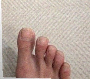 요즘 발 상태