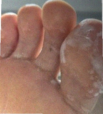 요즘 발 상태
