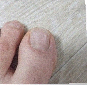 요즘 발 상태