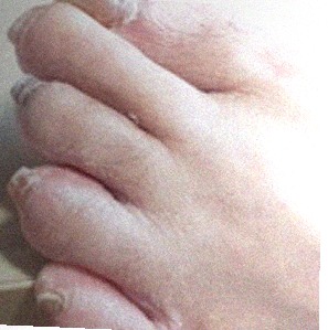 요즘 발 상태