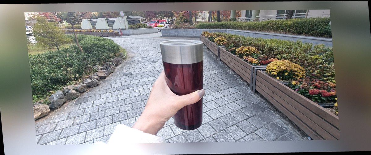 요즘 발 상태