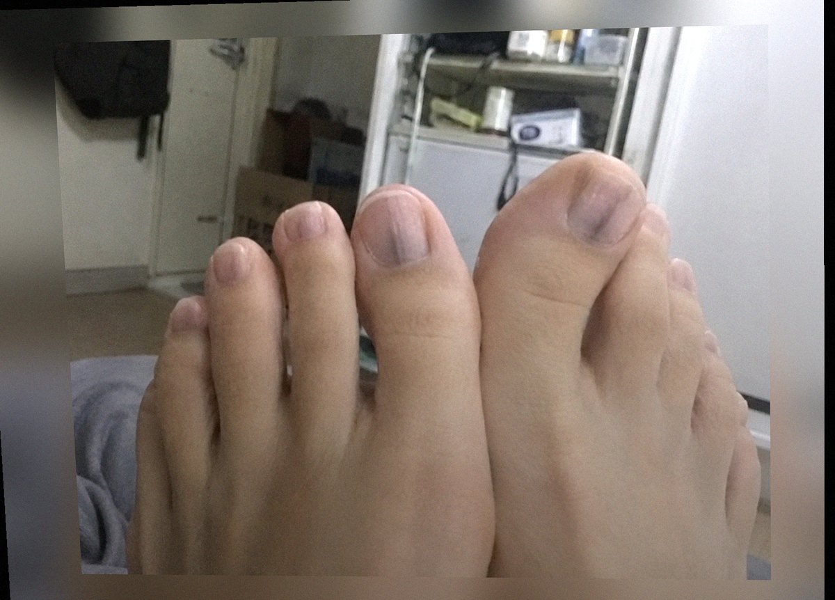 요즘 발 상태