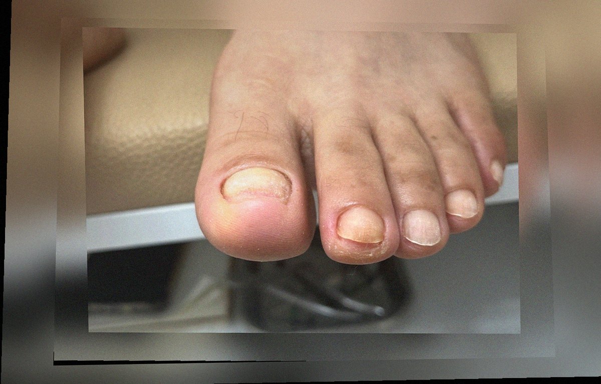요즘 발 상태