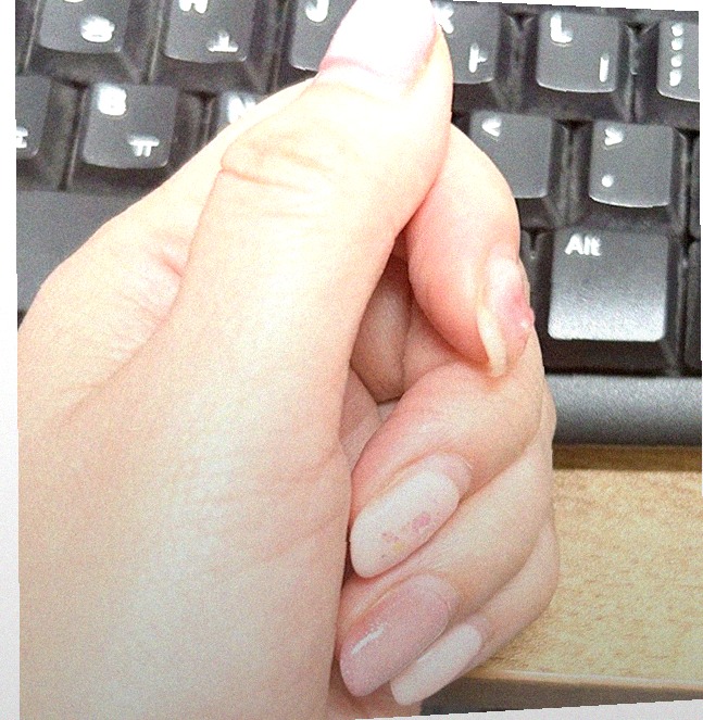 손 상태